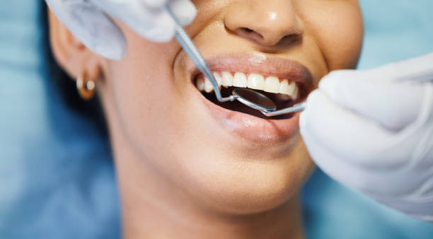 Best Lost Filling or Crown Replacement in Mission, TX